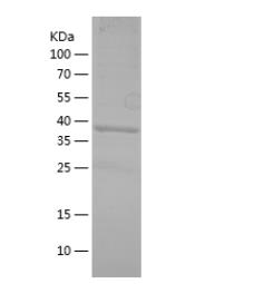 Recombinant Human ARR3.png