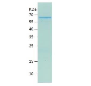 Recombinant Human ASAH1.png