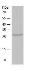 Recombinant Human ASB8.jpg