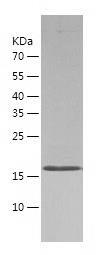 Recombinant Human ASF1b.jpg