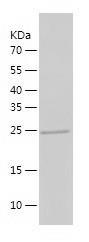 Recombinant Human ASGR2.jpg