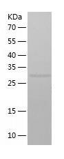 Recombinant Human ASPA.jpg