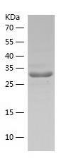 Recombinant Human ASRGL1.jpg