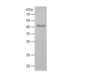 Recombinant Human ASS1.png