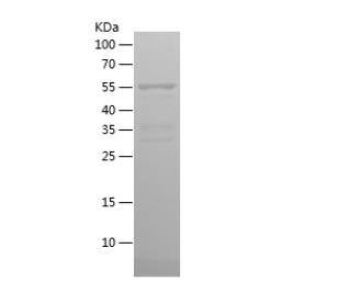 Recombinant Human ATF4.png
