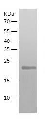 Recombinant Human ATG10.jpg