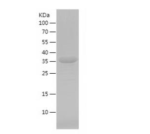 Recombinant Human ATG5.png
