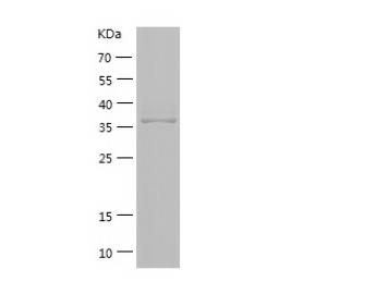Recombinant Human ATP1A2.png