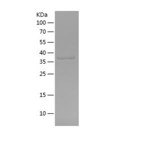 Recombinant Human ATP1B1.png