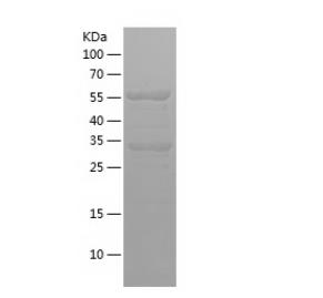 Recombinant Human ATXN2L.png