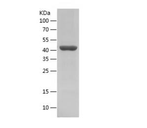 Recombinant Human ATXN3L.png
