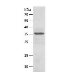Recombinant Human BACE1.png