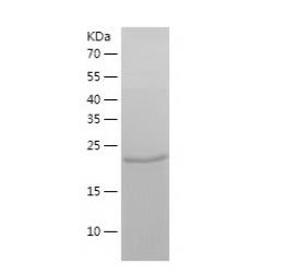 Recombinant Human BAG2.png