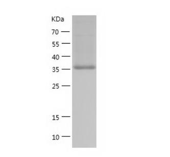 Recombinant Human BCAT1.png