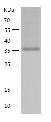 Recombinant Human BCAT2.jpg