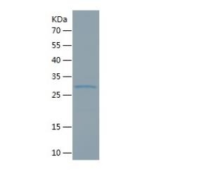 Recombinant Human Bcl10.png