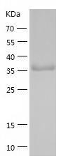 Recombinant Human BDH1.jpg