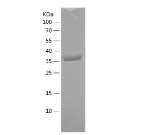 Recombinant Human BECN1.png