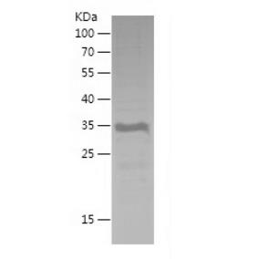 Recombinant Human Bmi1.png