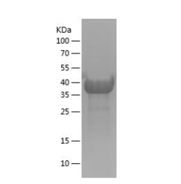 Recombinant Human BNIP3L.png