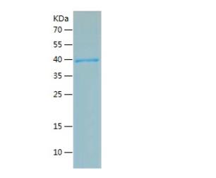 Recombinant Human BRCA2.png