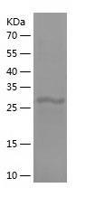 Recombinant Human C4b.jpg