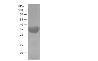 Recombinant Human C6.png