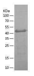 Recombinant Human CA9.jpg