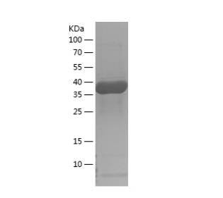 Recombinant Human CAB39L.png