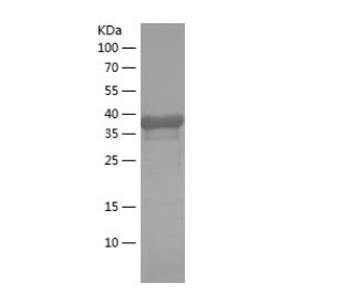 Recombinant Human CALB2.png