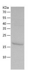 Recombinant Human calcyphosine.jpg
