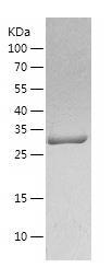 Recombinant Human Carbonic Anhydrase 1.jpg