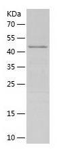 Recombinant Human Carbonic Anhydrase 8.jpg