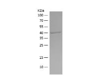 Recombinant Human Catalase.png