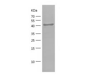 Recombinant Human CD44.png