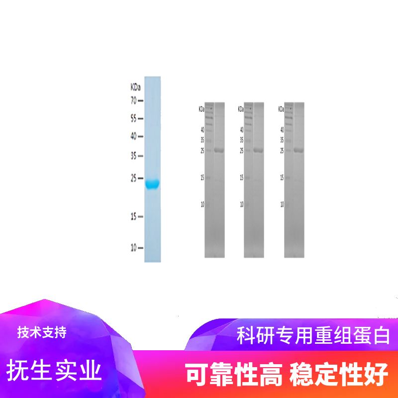 Recombinant Human Methionine Sulfoxide Reductase B