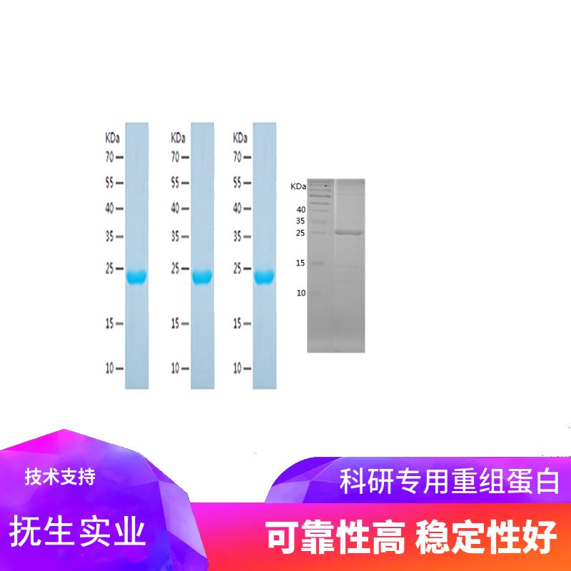 Recombinant Human Acid phosphatase