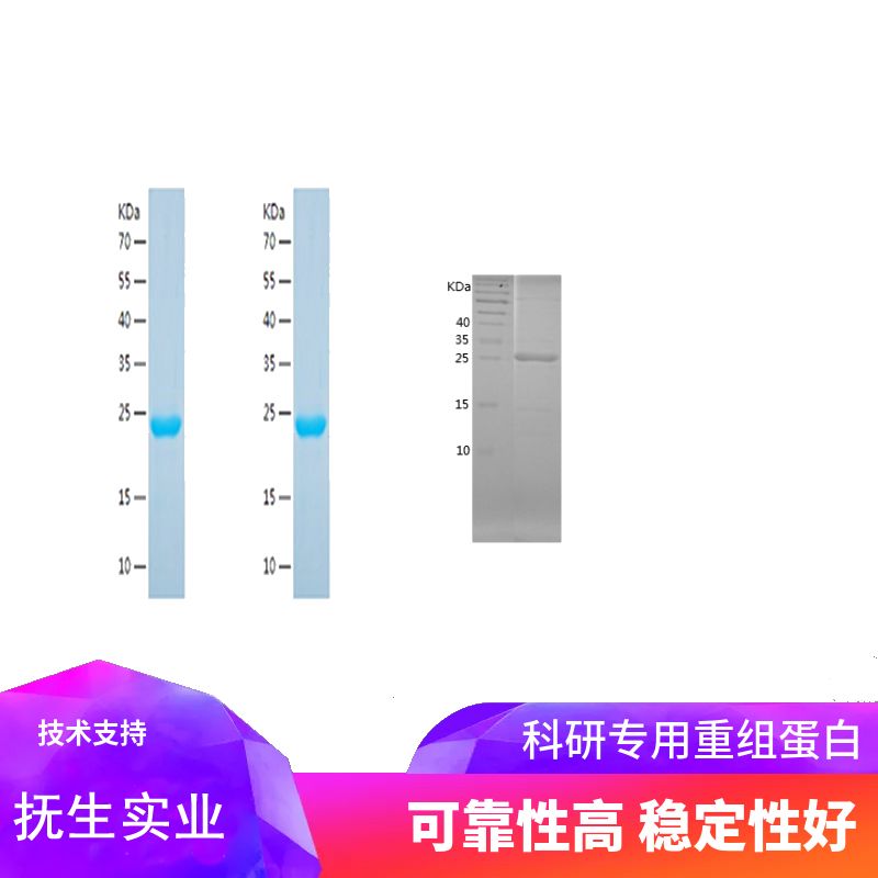 Recombinant Human GABARAPL1
