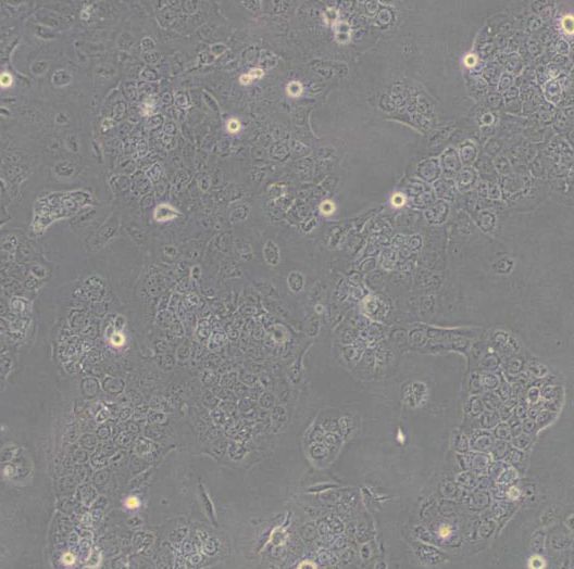 人神经上皮瘤细胞SKNMC（STR）
