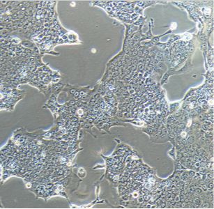 人结肠腺癌细胞SW948（STR）