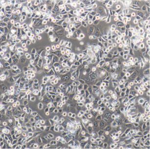 人滑膜肉瘤细胞SW982（STR）