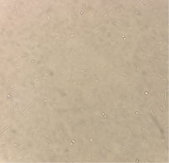 人胶质母细胞瘤T98G（STR）