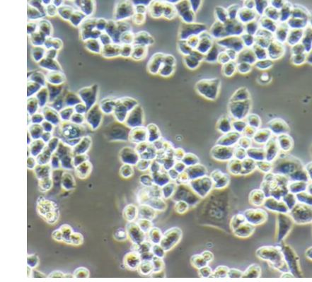 人甲状腺乳头状细胞TPC-1（文献引用产品）