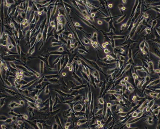 人喉癌细胞TU212（文献引用产品）