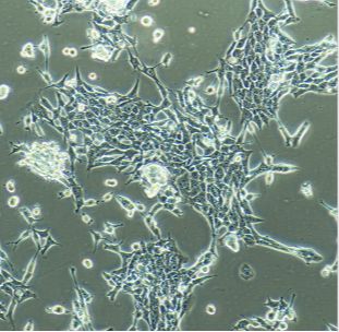 人膀胱移行细胞癌UMUC3（STR）
