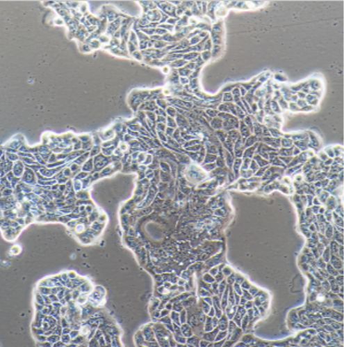 人肺鳞癌细胞NCIH2170（STR）