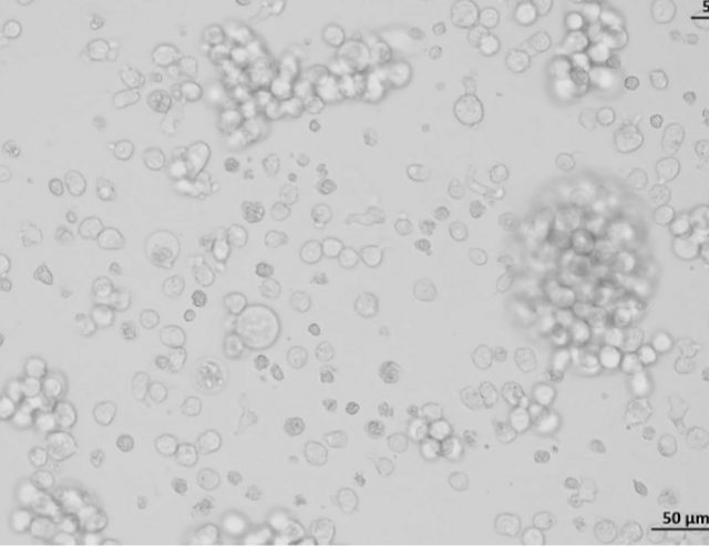 人肺鳞癌细胞NCIH2170（STR）