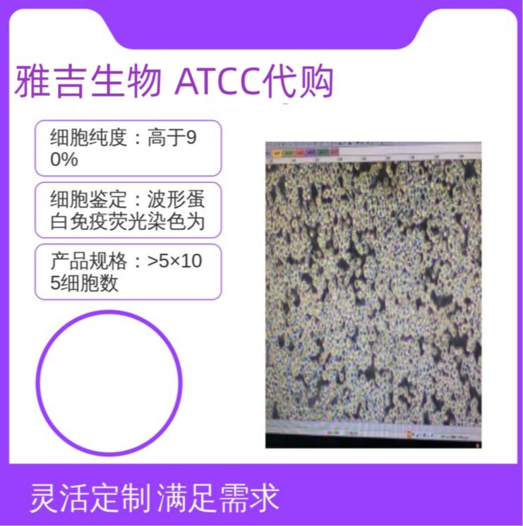 人肺鳞癌细胞NCIH2170（STR）