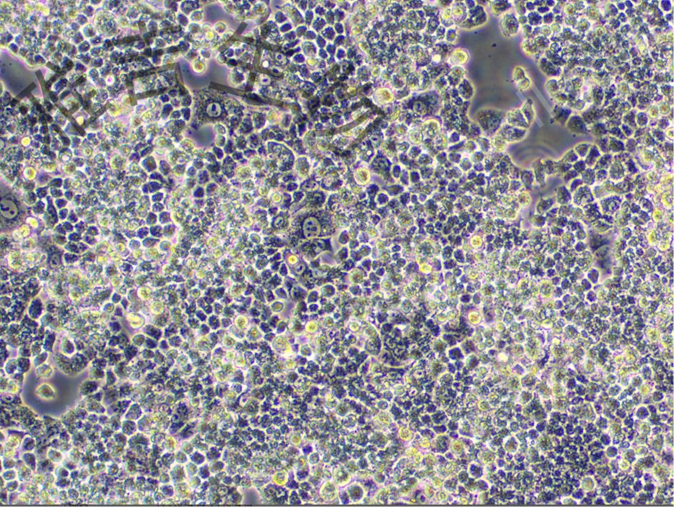 人肥大细胞系LUVA（STR）