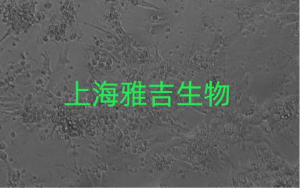 人食管癌细胞Kyse510（STR）